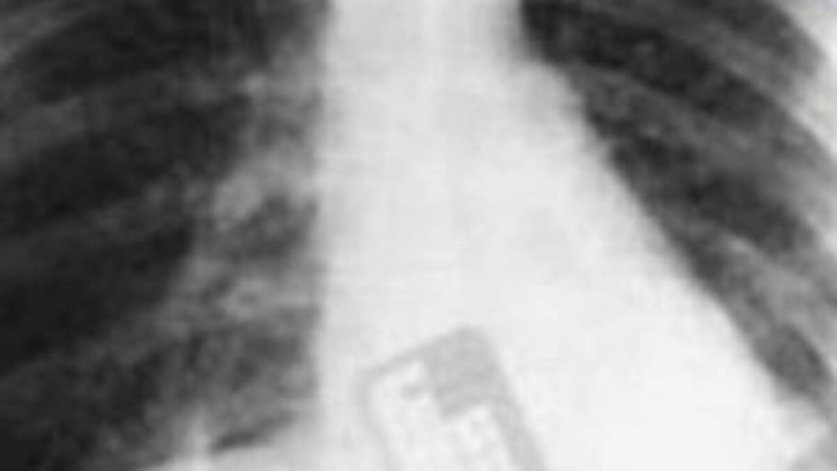 Escucha las notas curiosas