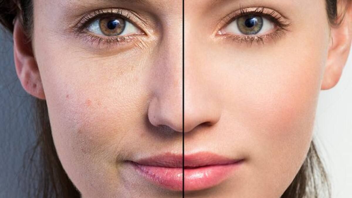 Noruega aprueba ley que prohíbe a las ‘influencers’ retocar sus fotos sin avisar