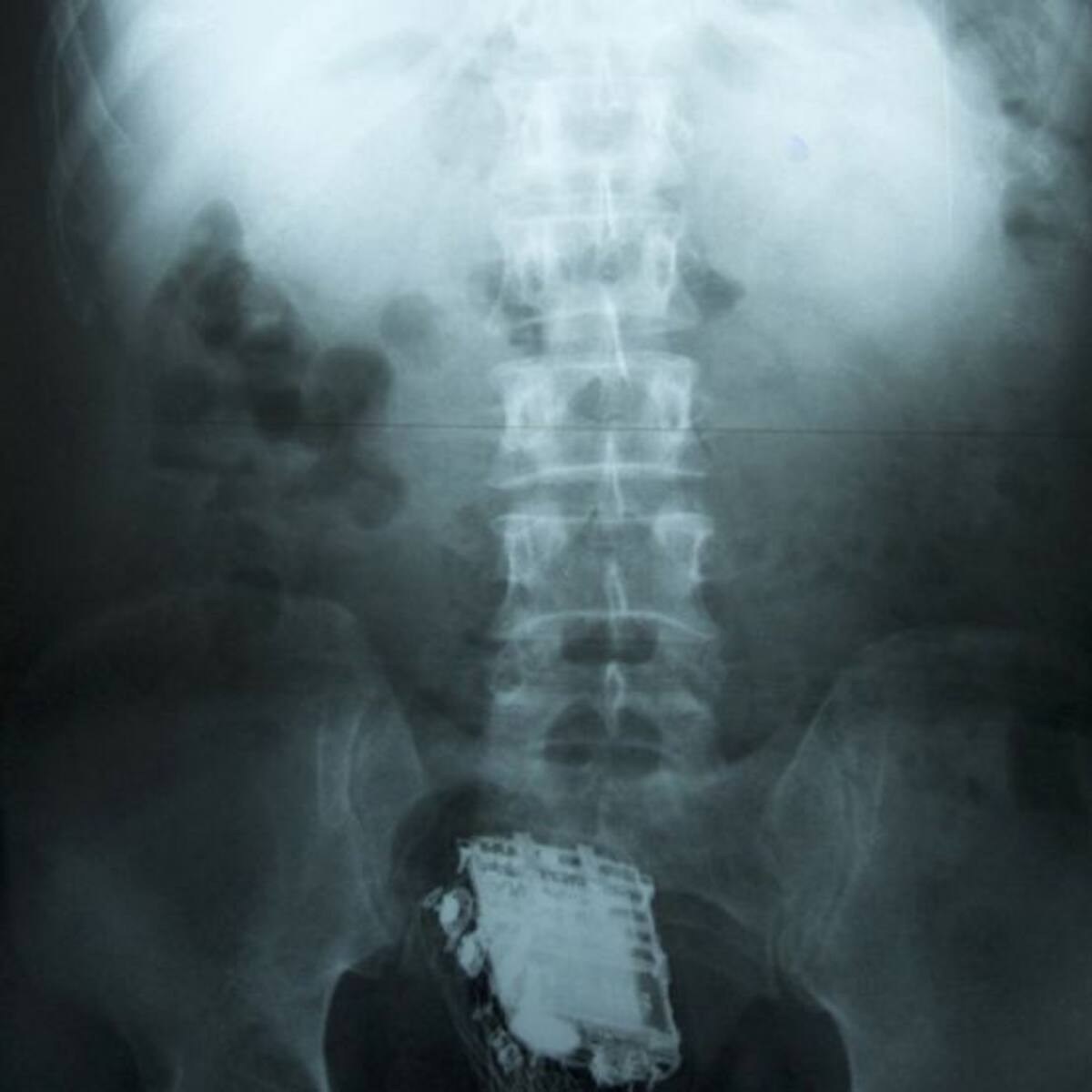 Recluso es sorprendido con un celular metido en el trasero