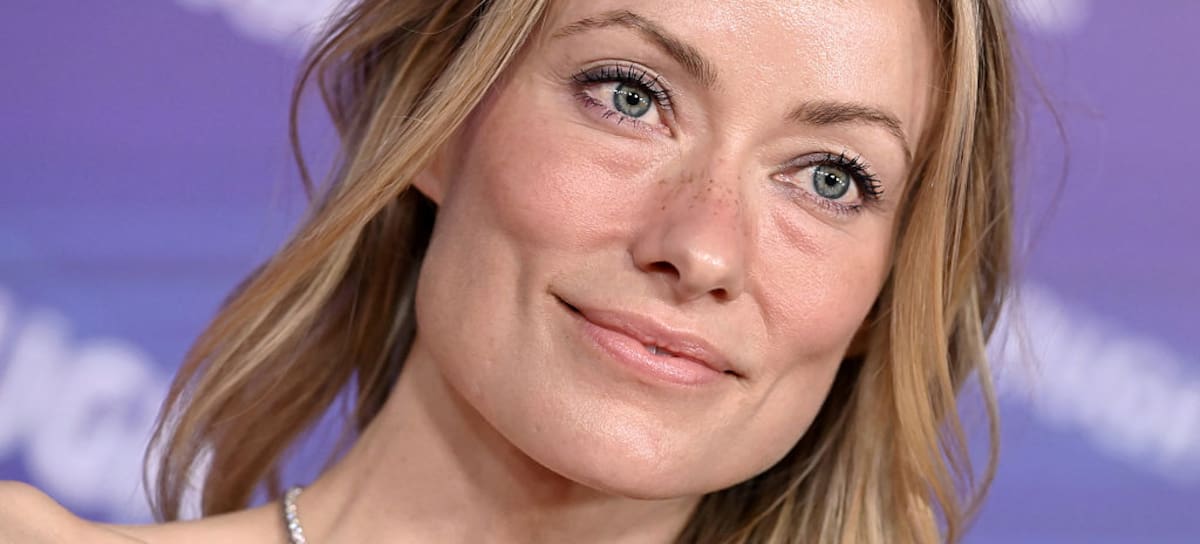 ¿Qué le pasó a Olivia Wilde en el rostro?