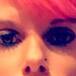 Se desfiguró el rostro con botox