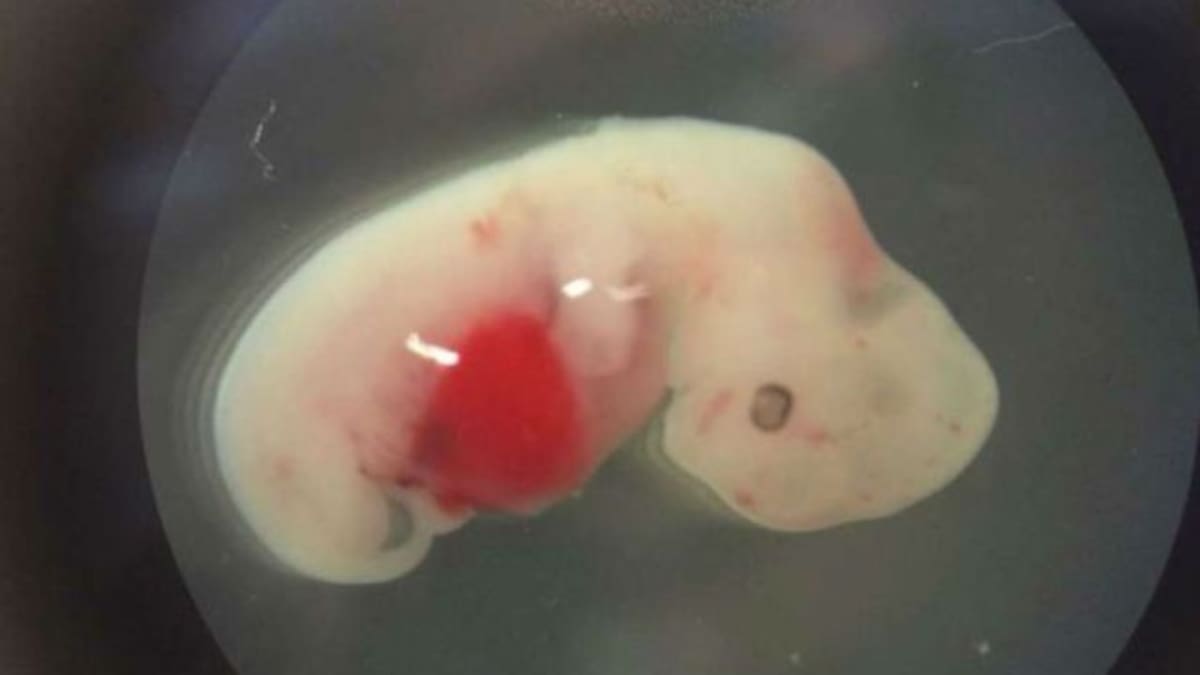 ¿Fusión de embriones de cerdos en humanos?