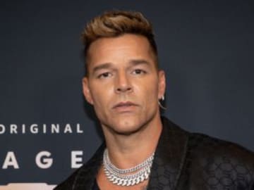 ¿Cirugía o alergia? Esto sabemos sobre los cambios en el rostro de Ricky Martin