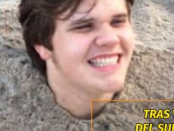 Se enterró en la arena y su piel se infectó