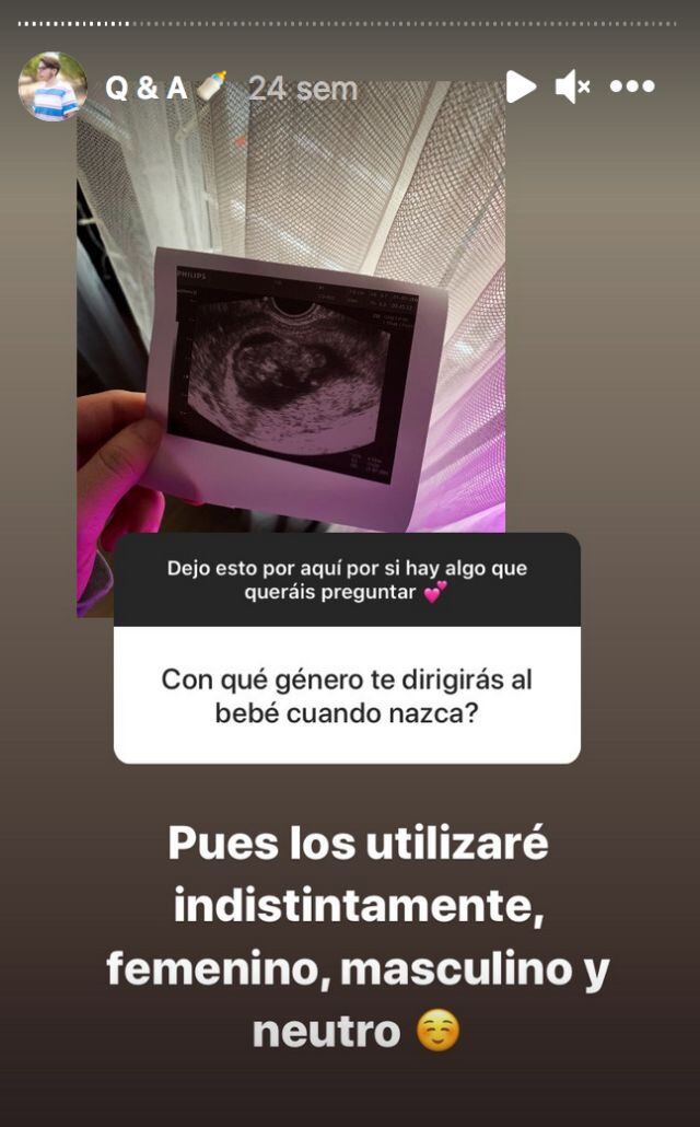 Rubén Castro no asignará un género a su bebé y le hablará en género indistinto