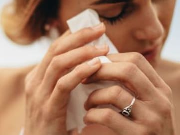 Perdió casi todo su cabello por el estrés de su boda
