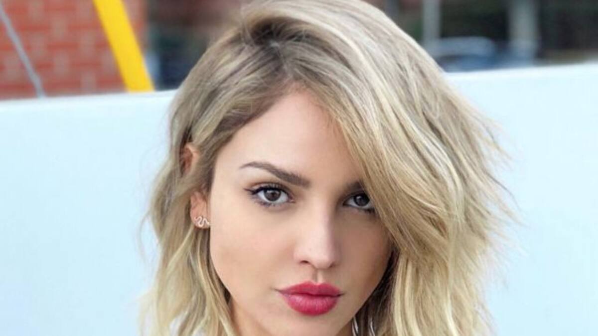 Eiza González comparte terrible enfermedad que la aqueja