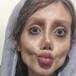 Así lucía la chica que se operó para parecerse a Angelina Jolie
