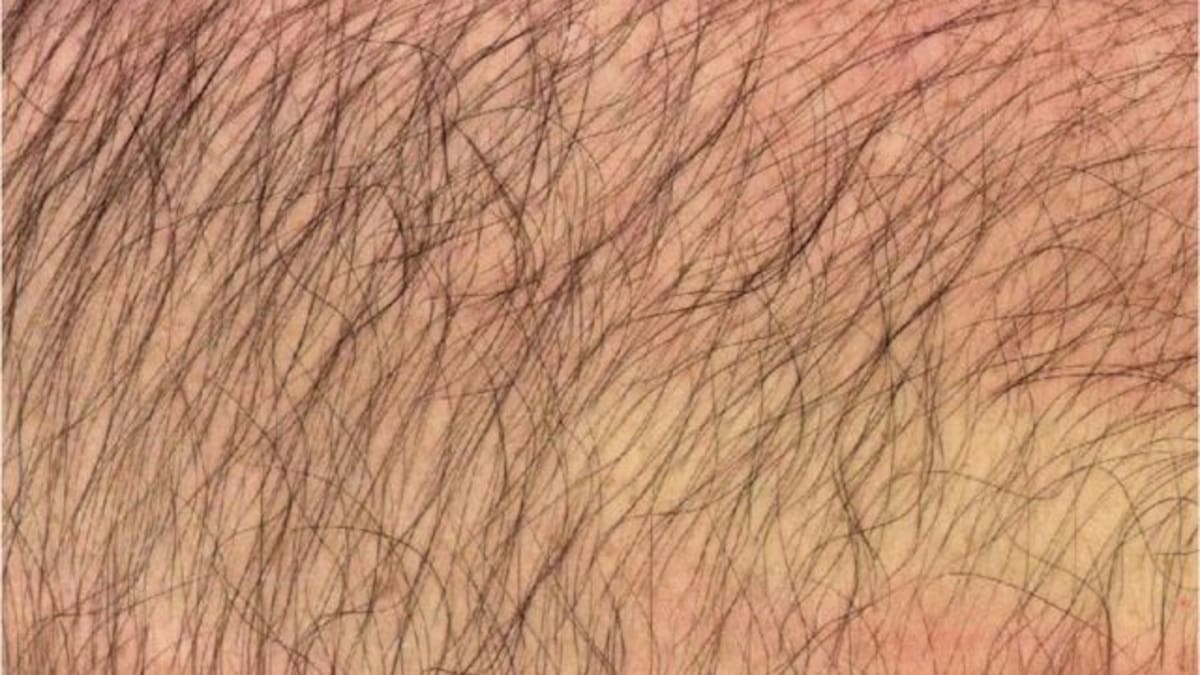 El vello está de moda