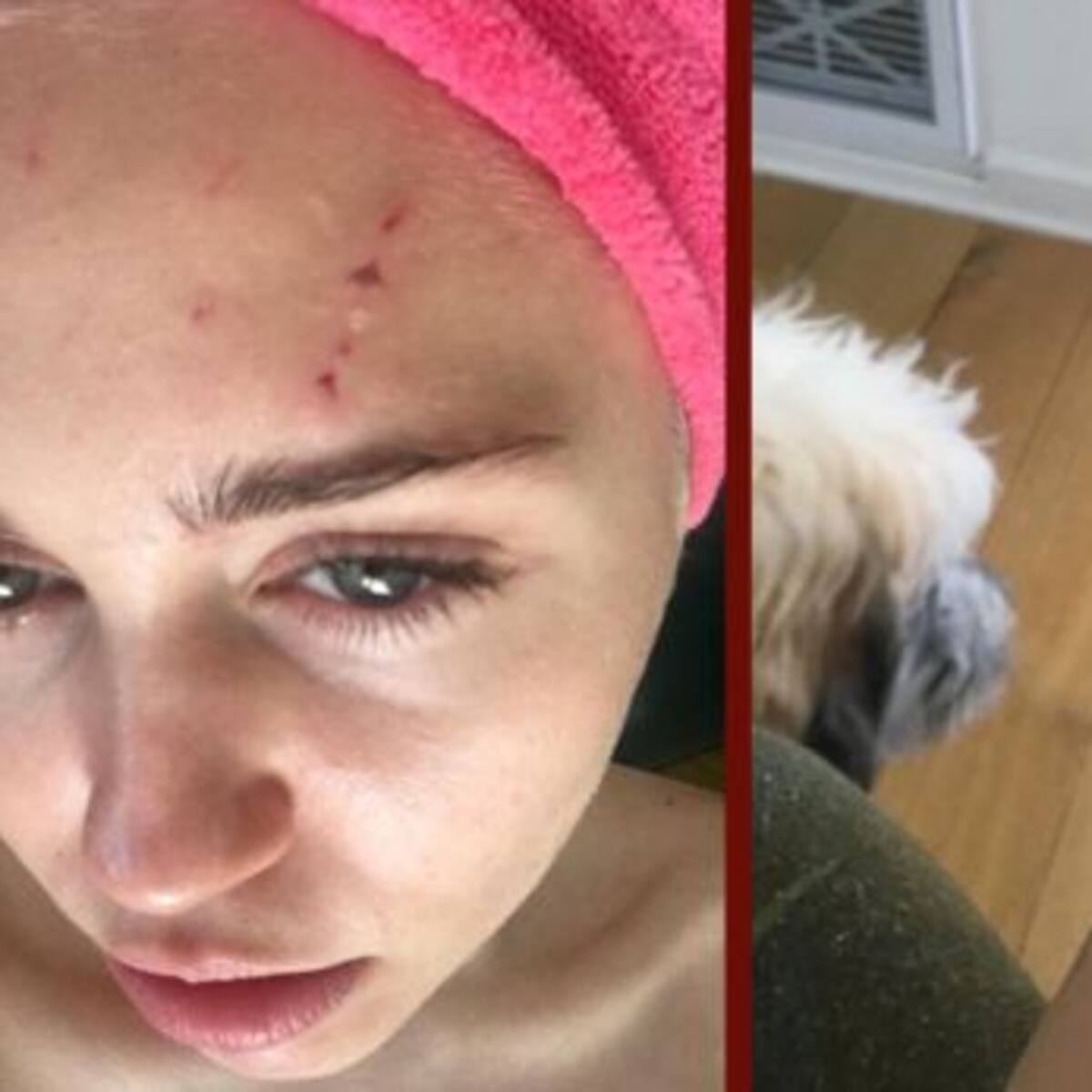 Miley Cyrus fue atacada por un gato