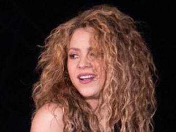 EL ANTES Y DESPUÉS DE LAS OPERACIONES DE SHAKIRA