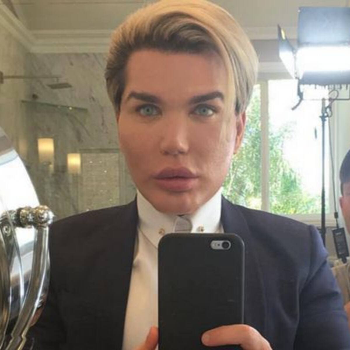 El "Ken humano" se quema la piel del rostro