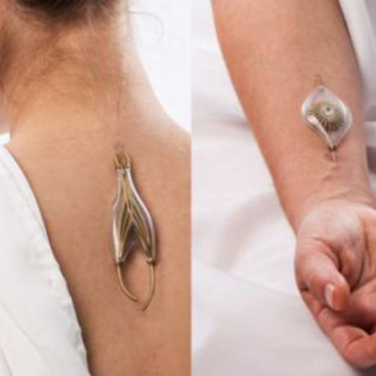 Joya se incrusta en las venas para crear energía