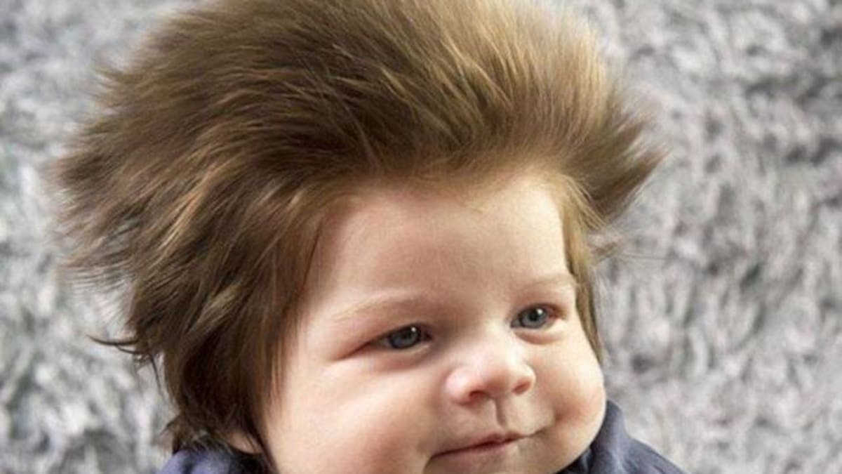 Este bebé se hizo famoso por su cabello largo