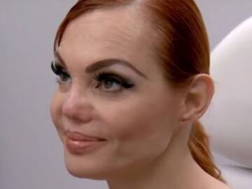 La reacción de Carmen Campuzano al saber que su nariz no tiene arreglo