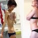 El antes y después de chicas que sufrieron anorexia