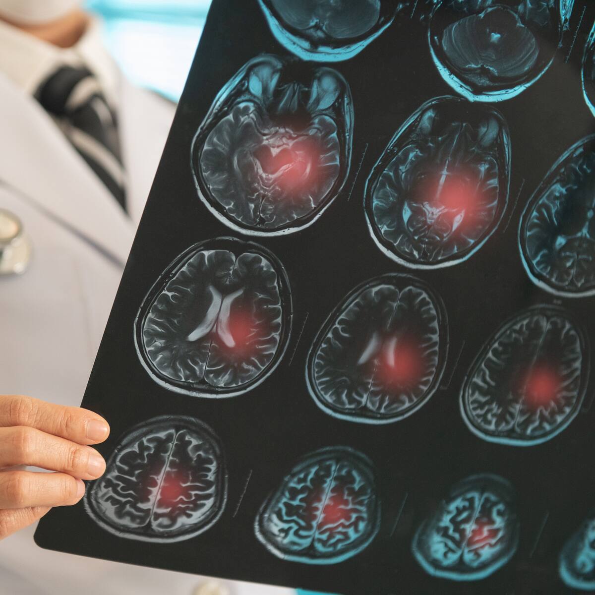 Estrella de programa de televisión sufre derrame cerebral en plena grabación