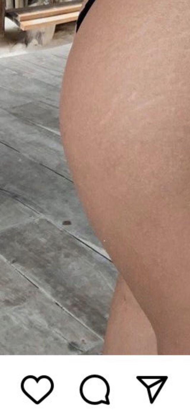 En la foto se puede ver cómo se alteró el piso por querer aumentar sus glúteos