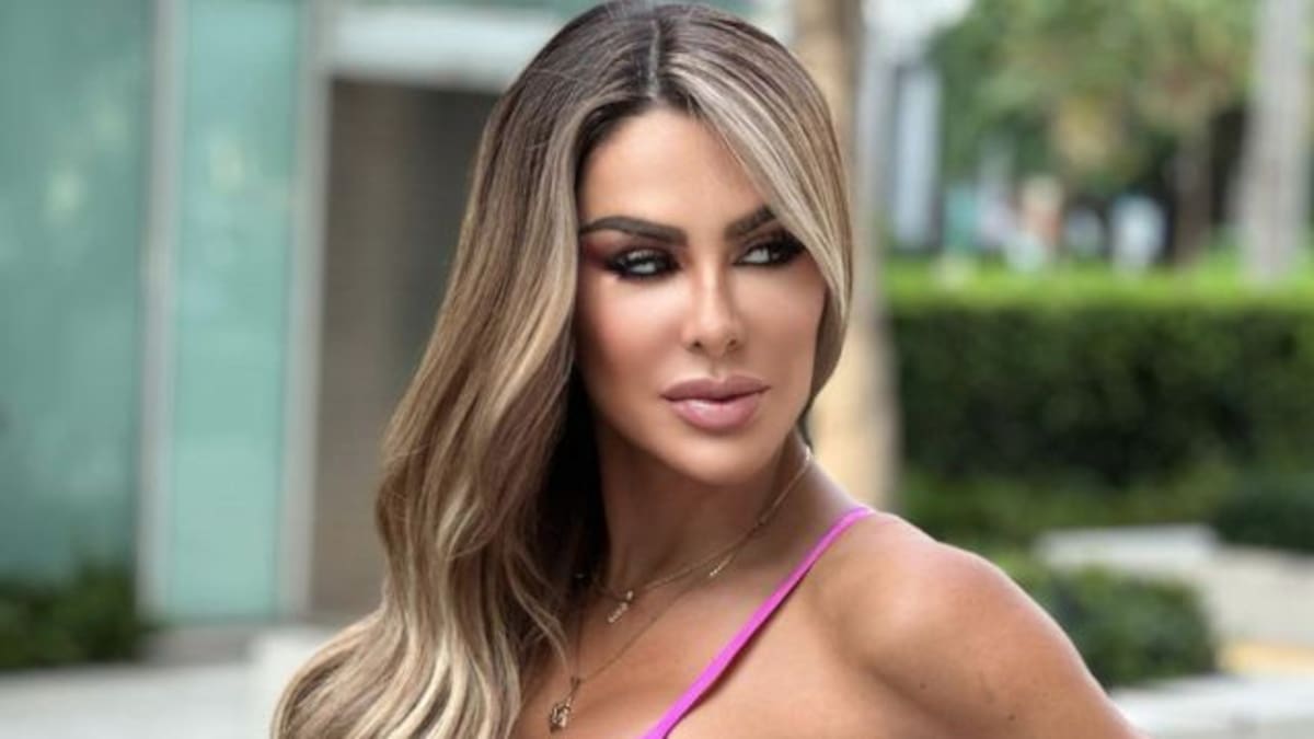 Ninel Conde impacta en las redes tras nueva cirugía, luce irreconocible