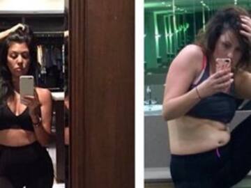 "Selfies", problema de autoestima.