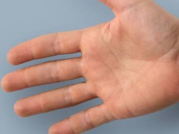 Crean tatuaje para detectar el cáncer