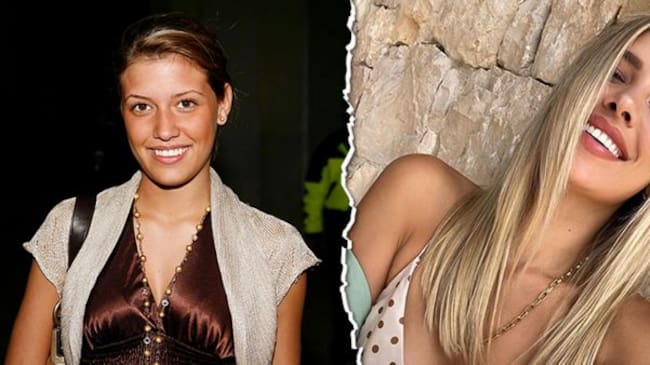 Michelle Salas antes y después de sus cirugías