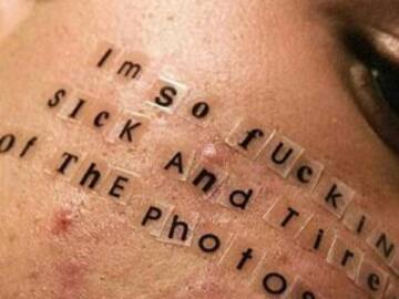 Cara Delevingne causa furor con fotografía de ácne