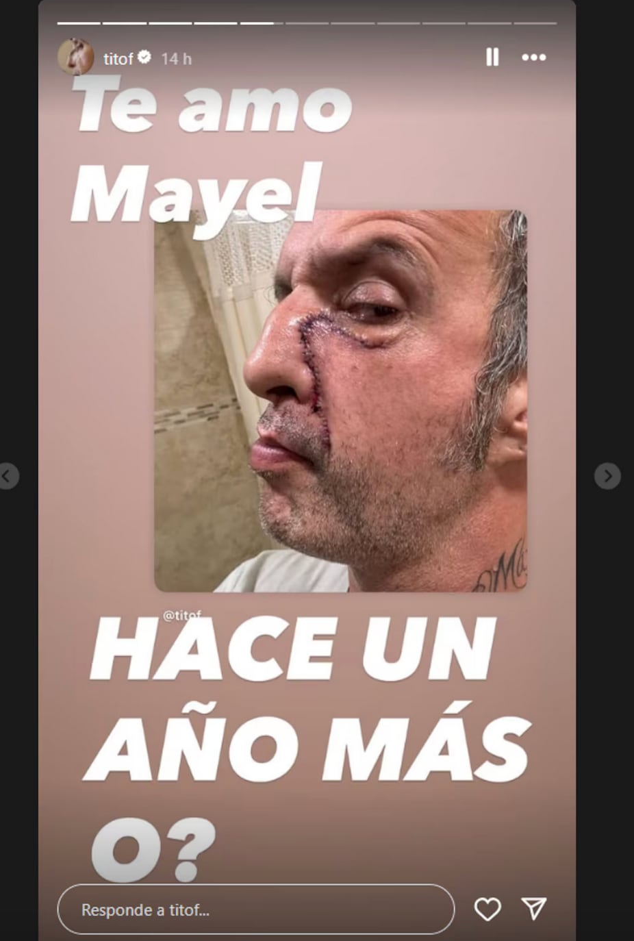 Tito fuentes cicatrices