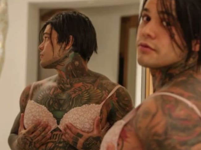 Influencer colombiano se puso implantes para cumplir reto viral