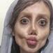 Así lucía la chica que se operó para parecerse a Angelina Jolie