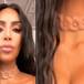 El collar implantado en el cuello de Kim Kardashian