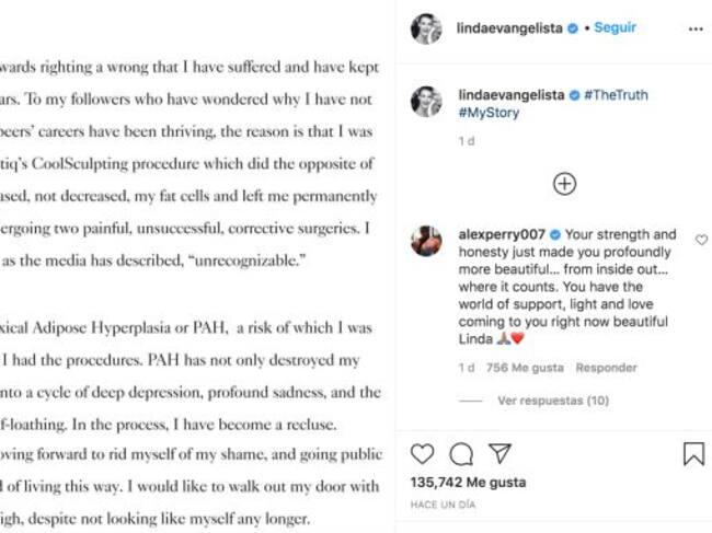 La supermodelo habló sobre su estado anímico actual.