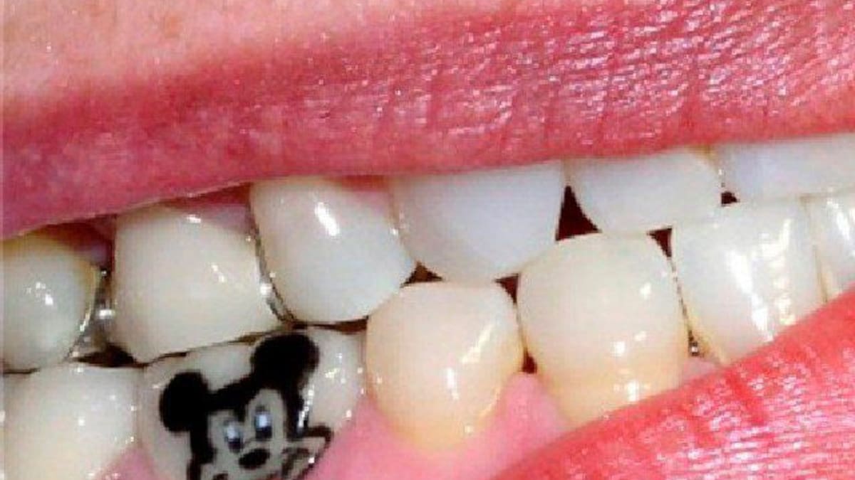 Ahora ya puedes tatuarte los dientes