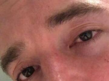 La aparatosa caída de J Balvin