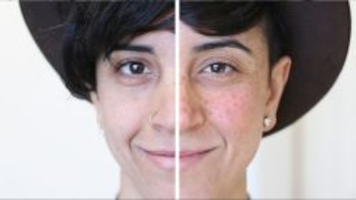 Tatuarse pecas, la tendencia de moda
