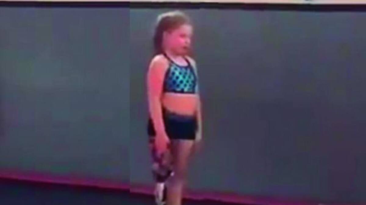 Viralizan a esta hermosa gimnasta con prótesis