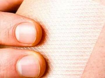 Parche Anticruda afecta la salud al tener efectos secundarios