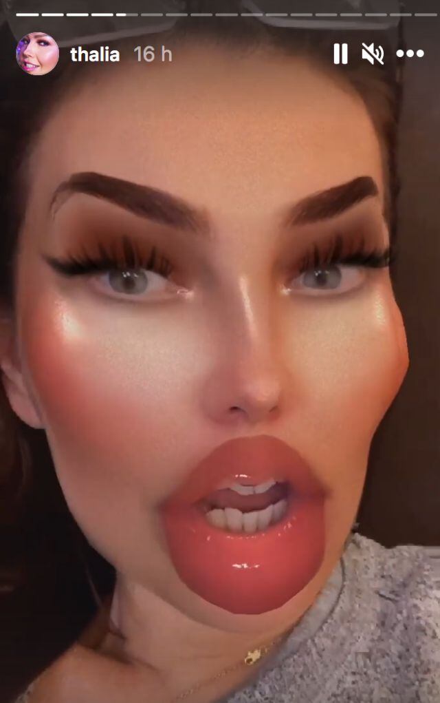 Thalía y el famoso filtro de labios