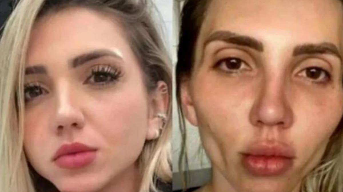 Influencer se hace la bichectomía y se arrepiente del resultado