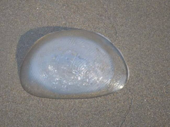 Descubrieron que era un implante y no una medusa