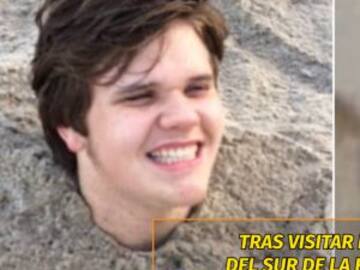 Se enterró en la arena y su piel se infectó