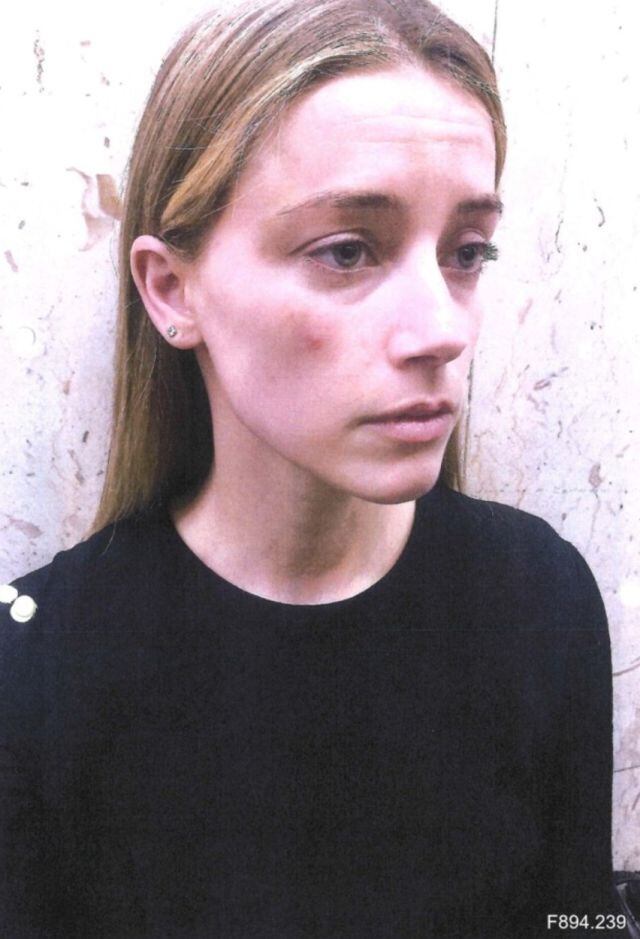 De acuerdo con el actor, Amber editó las fotografías para que "pareciera" que había sido golpeada