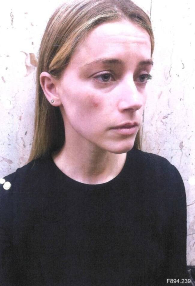 De acuerdo con el actor, Amber editó las fotografías para que "pareciera" que había sido golpeada