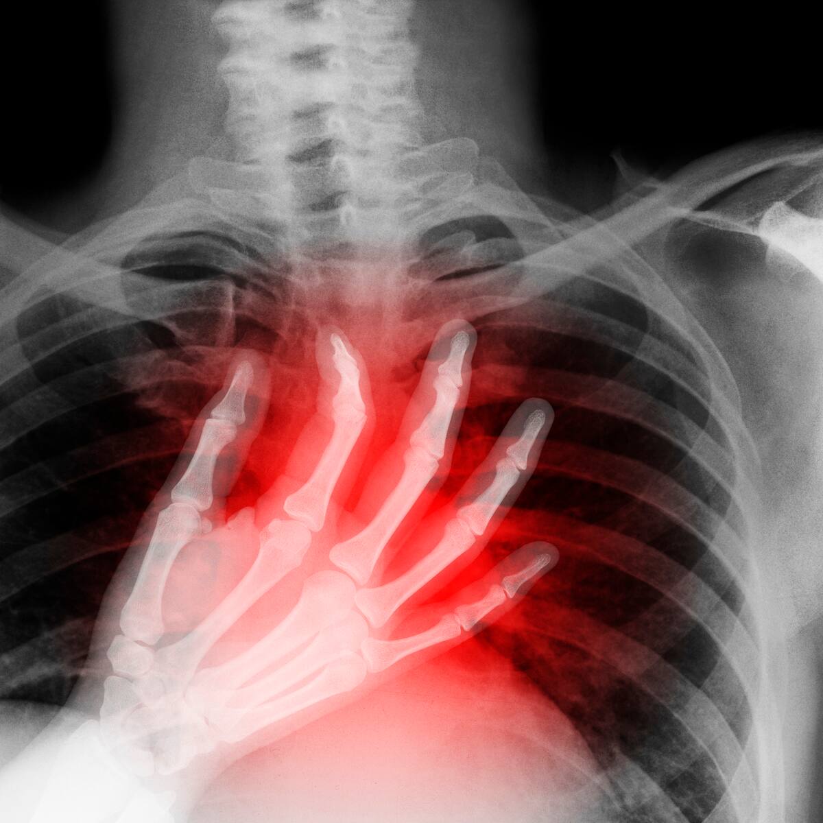 Muere reina de belleza a los 22 años tras una vida marcada por siete cirugías cardiacas