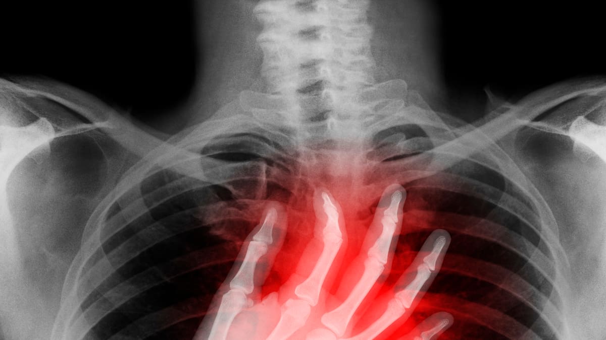 Muere reina de belleza a los 22 años tras una vida marcada por siete cirugías cardiacas