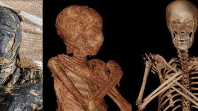 Fotos de los estudios realizados a la momia