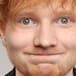 Ed Sheeran sufre accidente que pone en riesgo su carrera