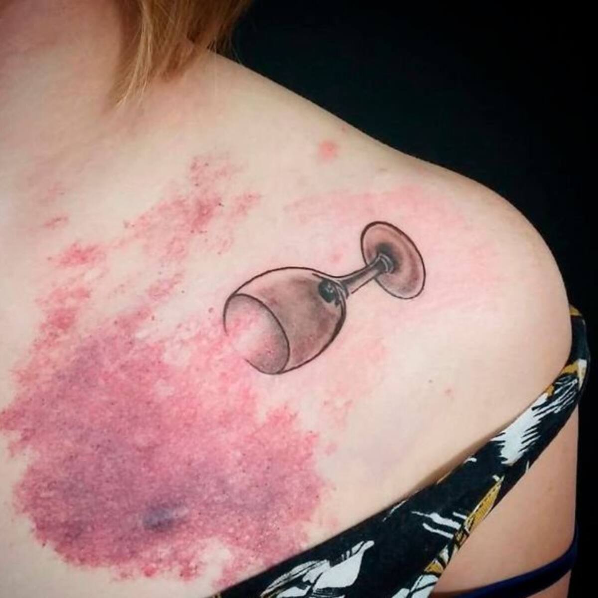 Personas que cubrieron sus cicatrices y marcas de nacimiento con divertidos tatuajes