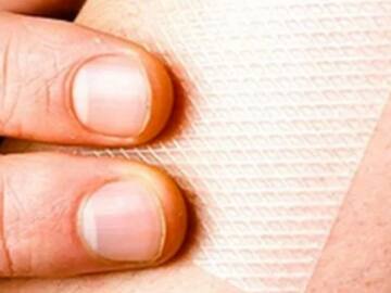 El parche anti-cruda podría afectar tu salud