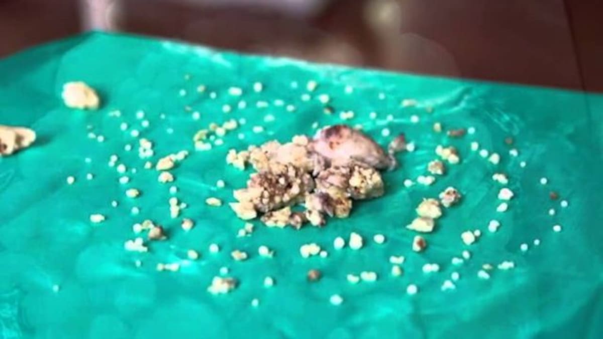 Le extraen 232 dientes